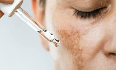 What The Various Spots On Your Face Indicate About Your Well-being