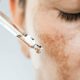 What The Various Spots On Your Face Indicate About Your Well-being
