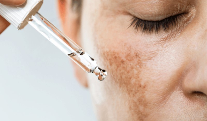 What The Various Spots On Your Face Indicate About Your Well-being