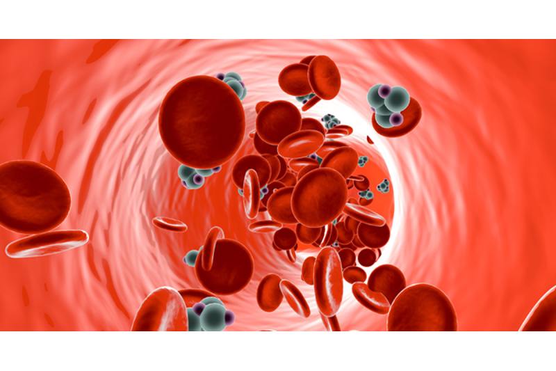 Hyperglycemia