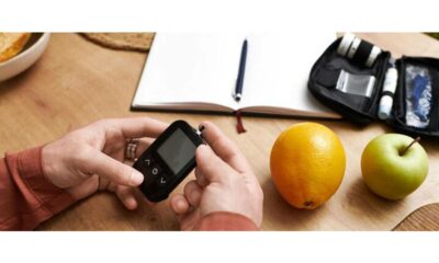 CGM