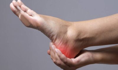 Diabetes and Foot Problems