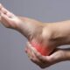Diabetes and Foot Problems